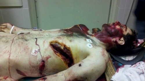 tamerlan-tsarnaev-death-photo